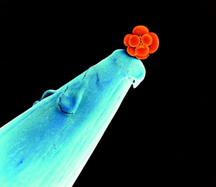 #10 Embryo na špičke ihly